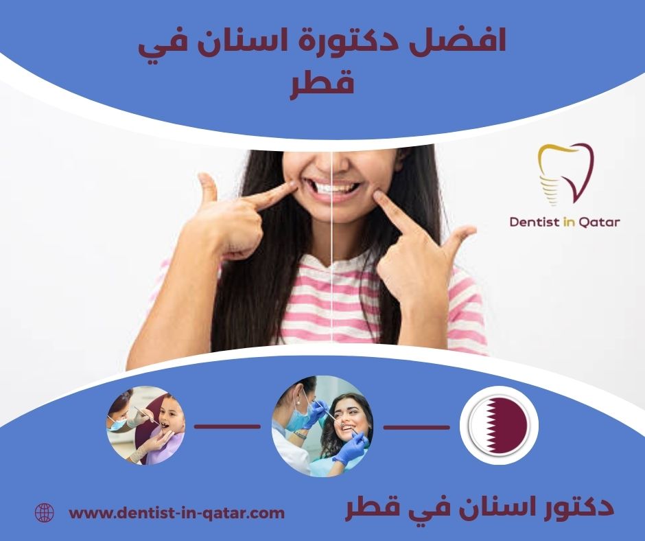 افضل دكتورة اسنان في قطر