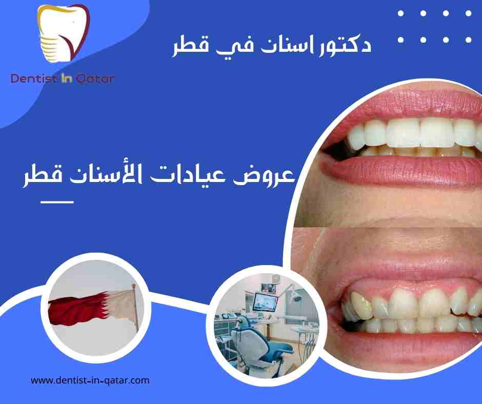 عروض عيادات الأسنان قطر