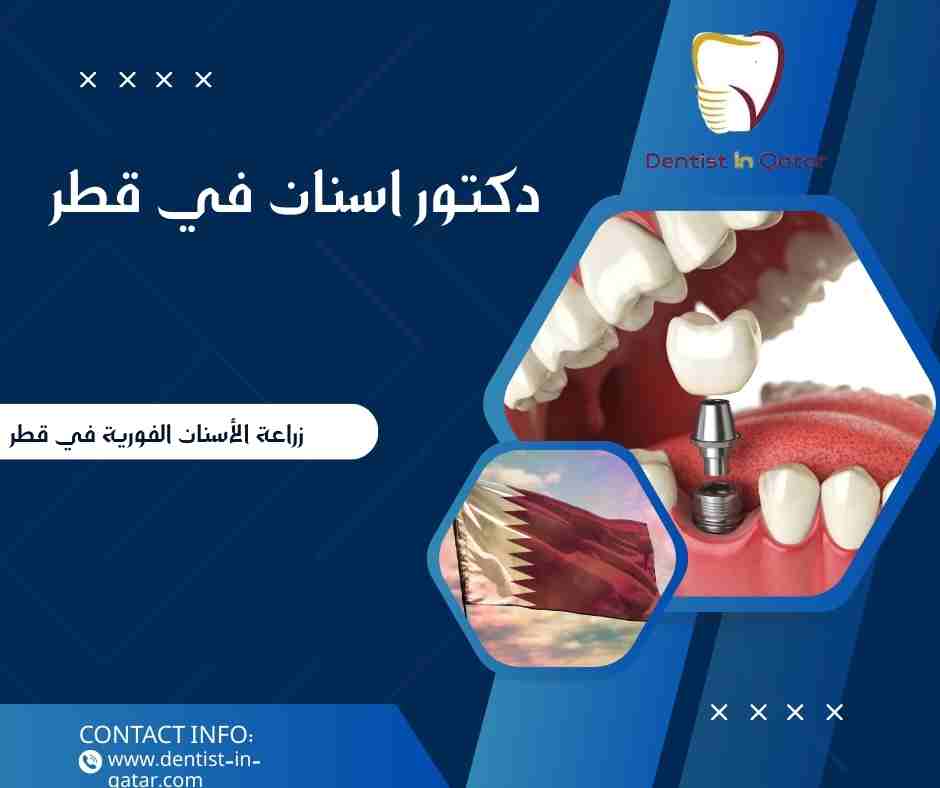 زراعة الأسنان الفورية في قطر