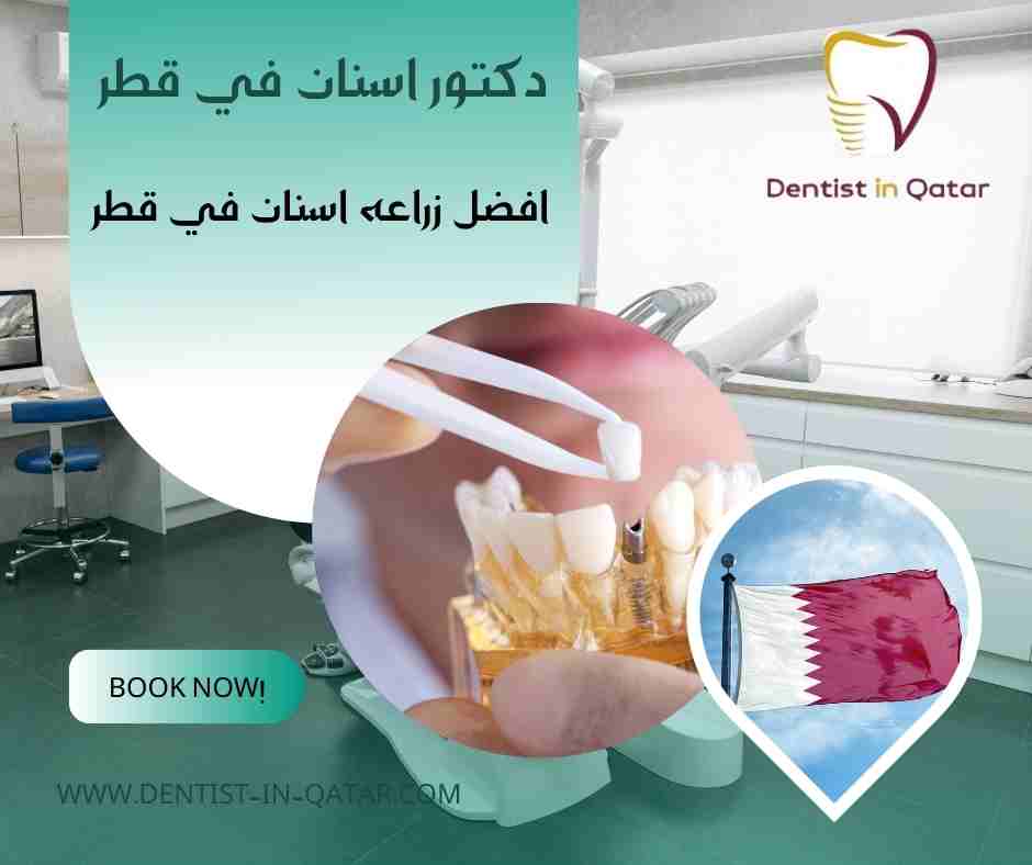 افضل زراعه اسنان في قطر