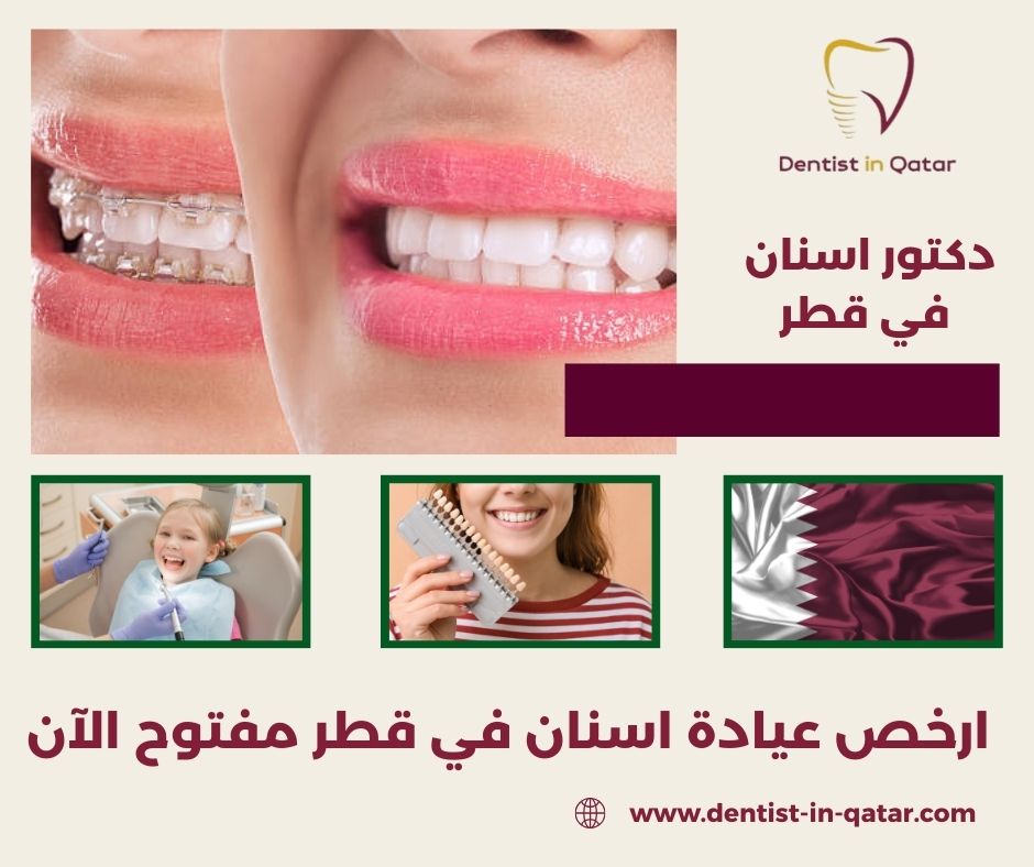 ارخص عيادة اسنان في قطر مفتوح الآن