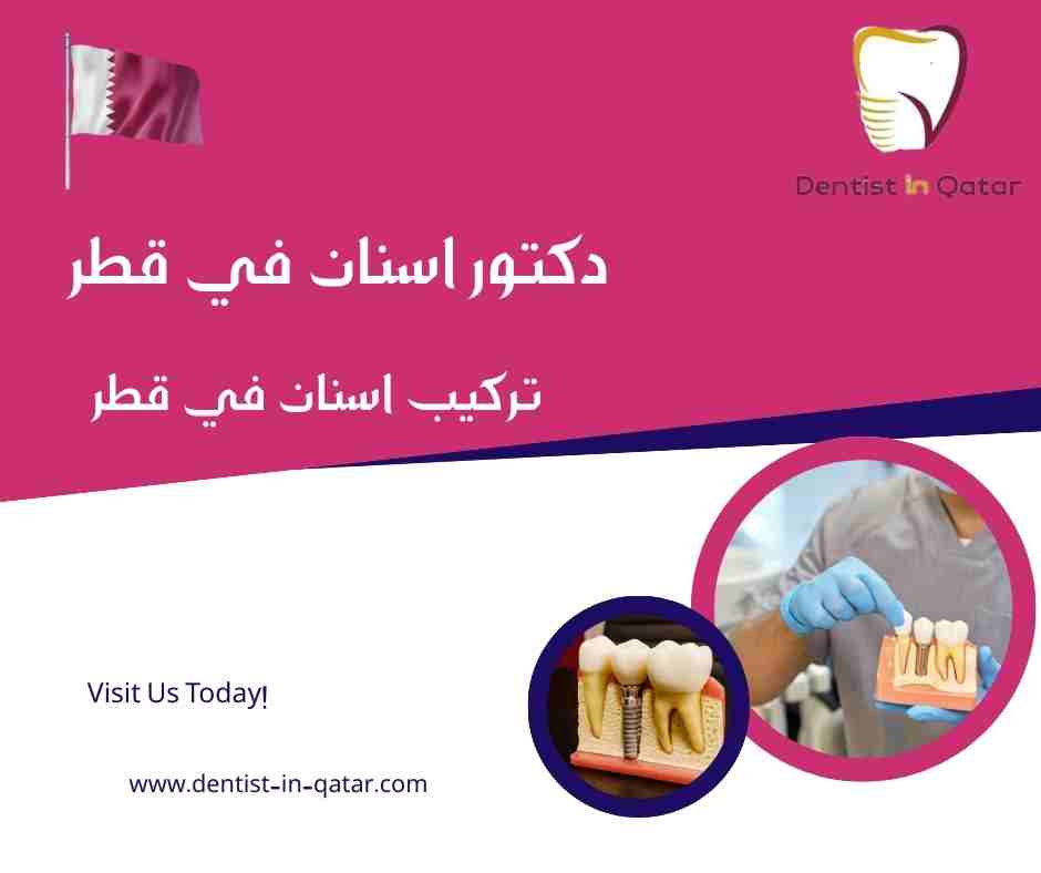 تركيب اسنان في قطر