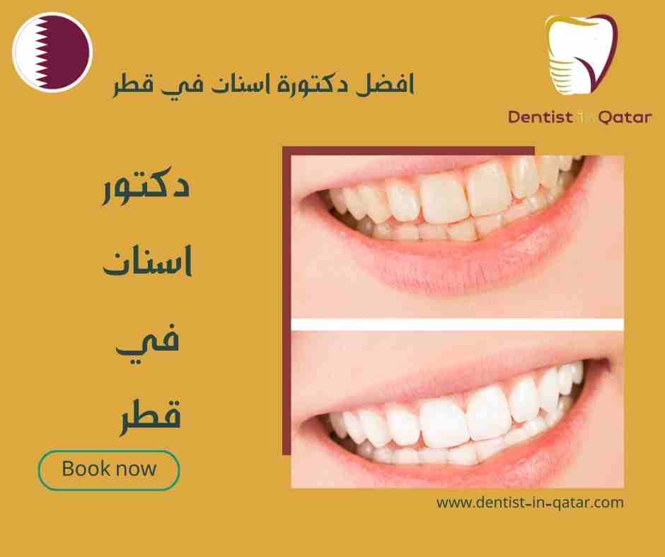 افضل دكتورة اسنان في قطر