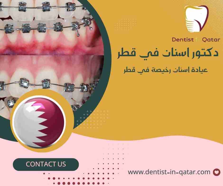 عيادة اسنان رخيصة في قطر