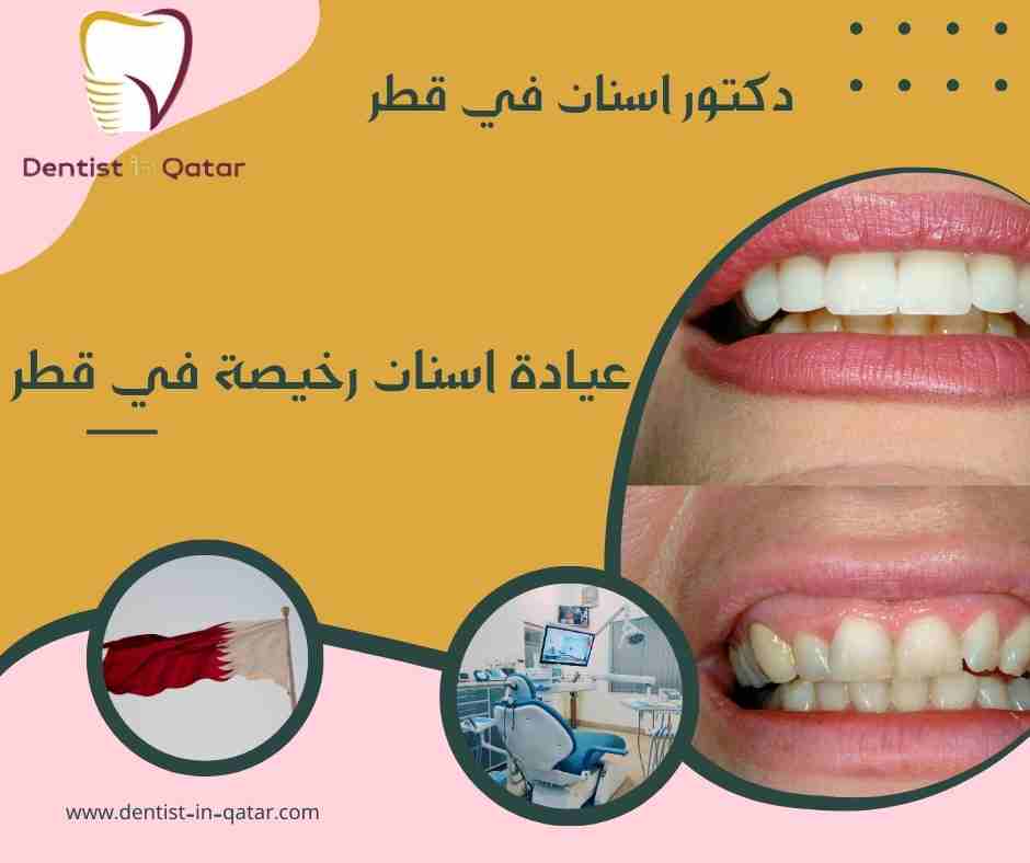 عيادة اسنان رخيصة في قطر