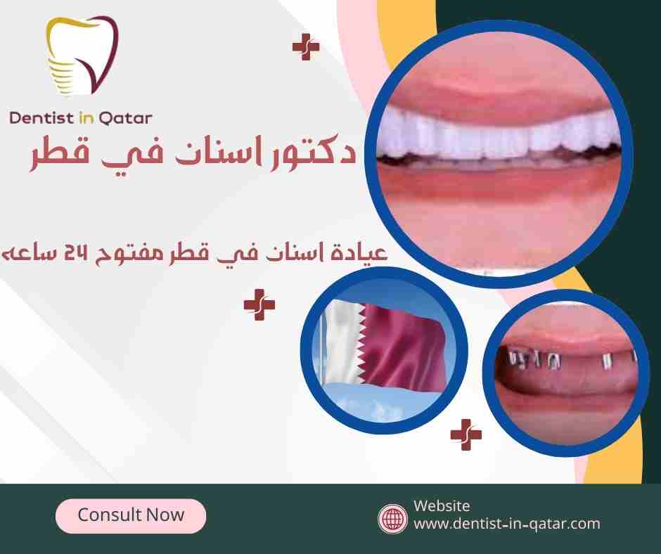 عيادة اسنان في قطر مفتوح 24 ساعه