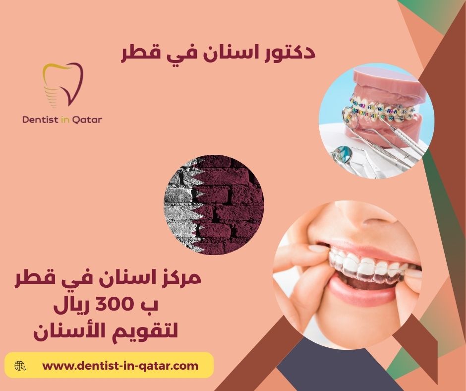 مركز أسنان في قطر ب 300 ريال لتقويم الأسنان