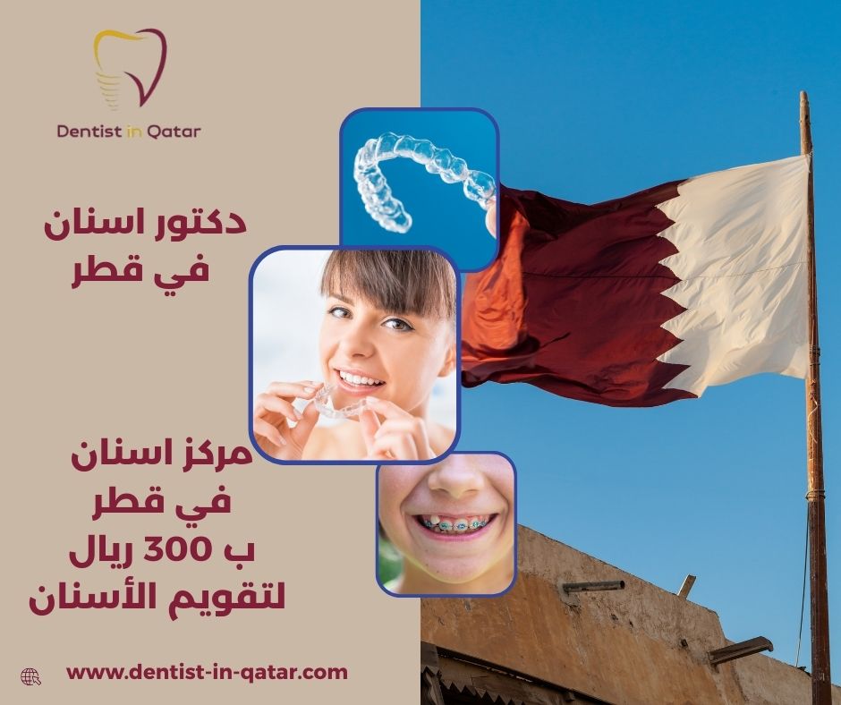 تقويم اسنان في قطر
