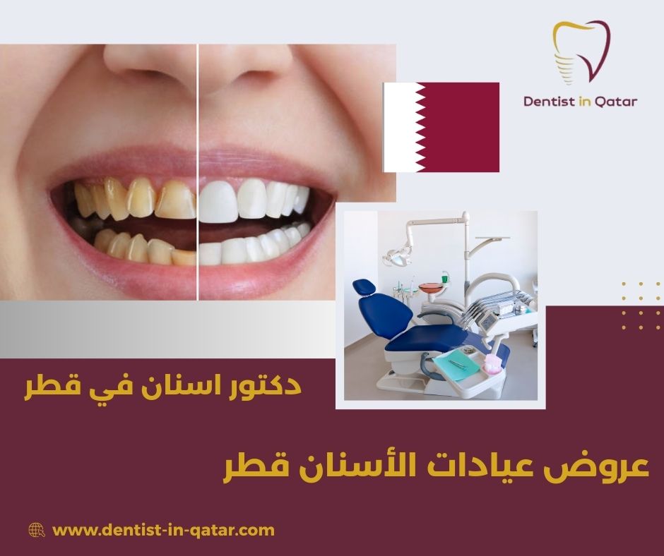 عروض عيادات الأسنان قطر