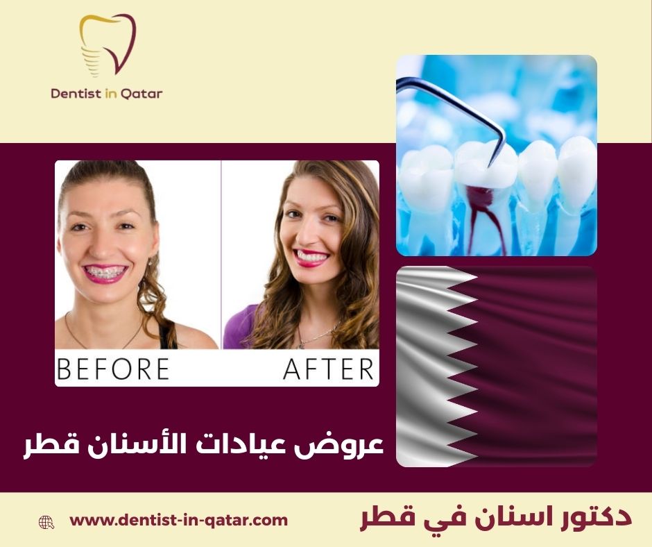 أسعار عيادات الأسنان في قطر