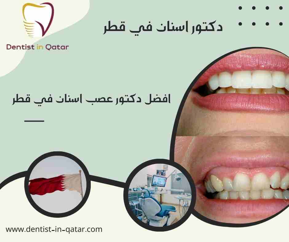 افضل دكتور عصب اسنان في قطر