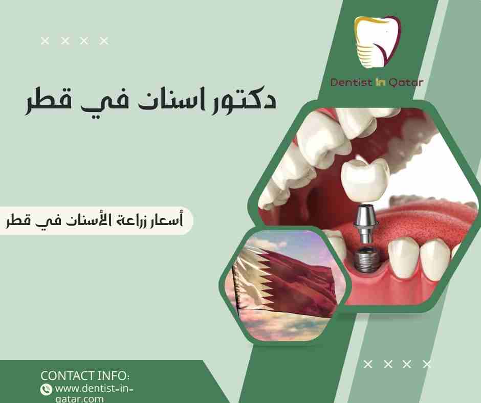 أسعار زراعة الأسنان في قطر