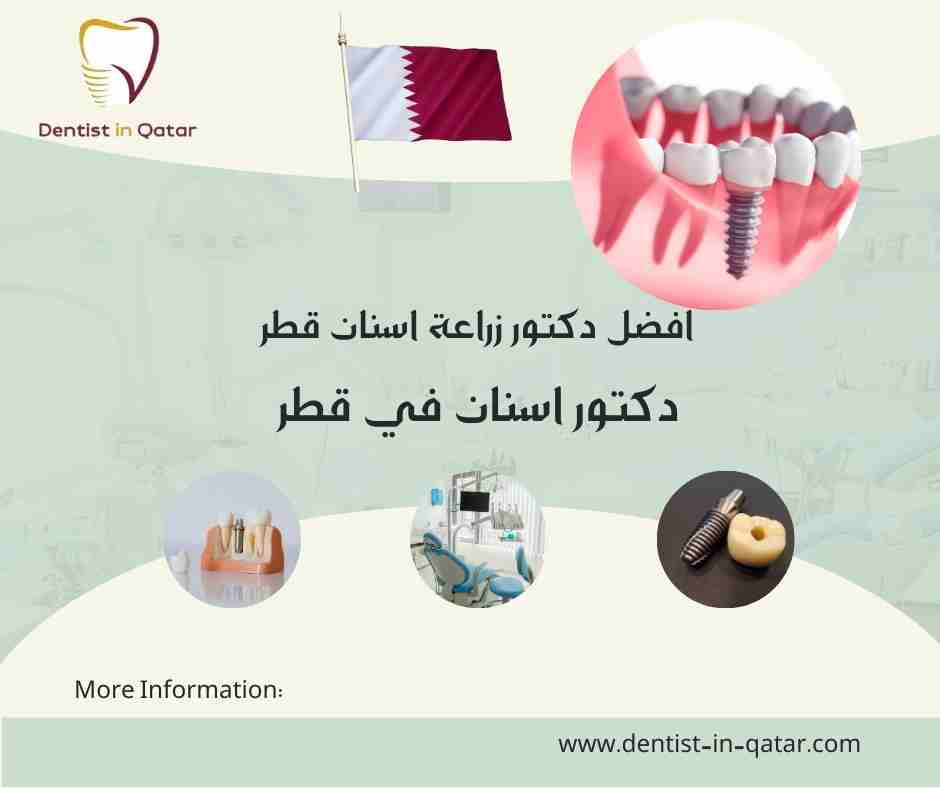 افضل دكتور زراعة اسنان قطر