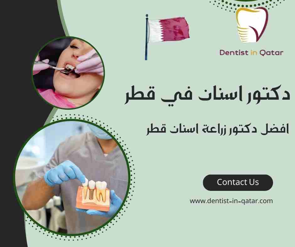 افضل دكتور زراعة اسنان قطر