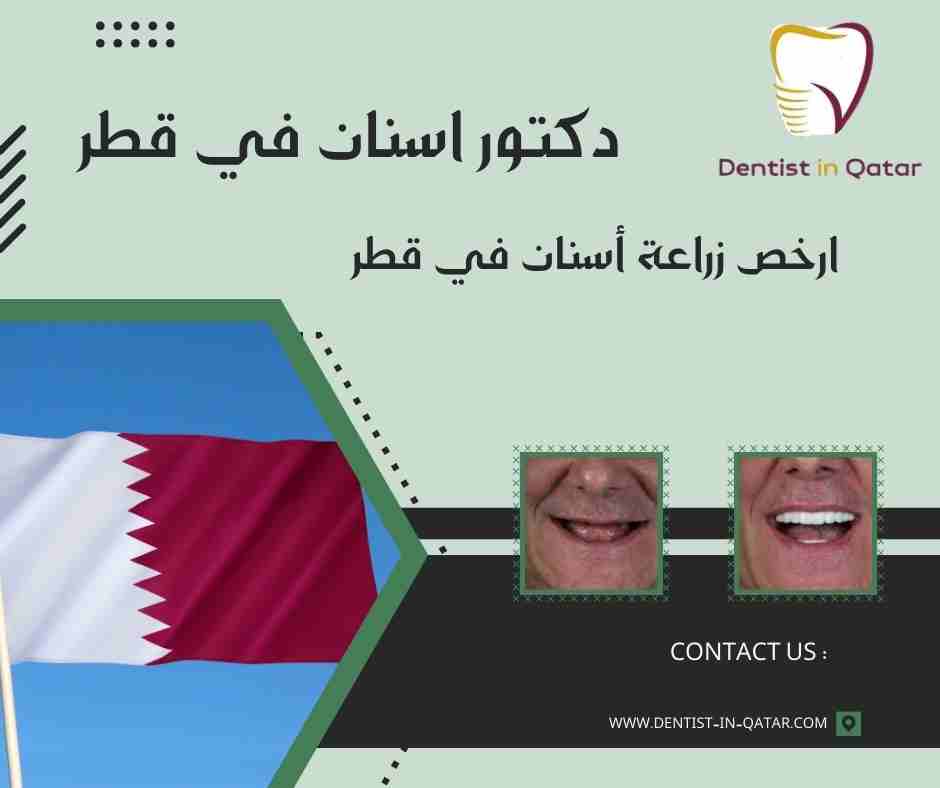  ارخص زراعة أسنان في قطر