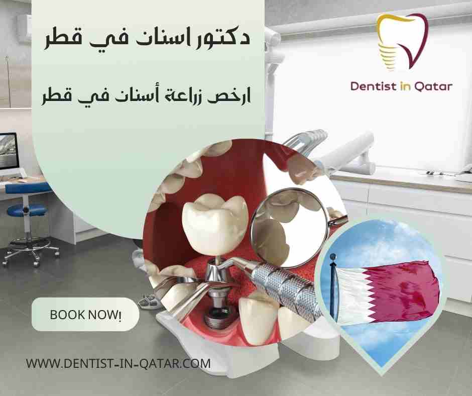  ارخص زراعة أسنان في قطر