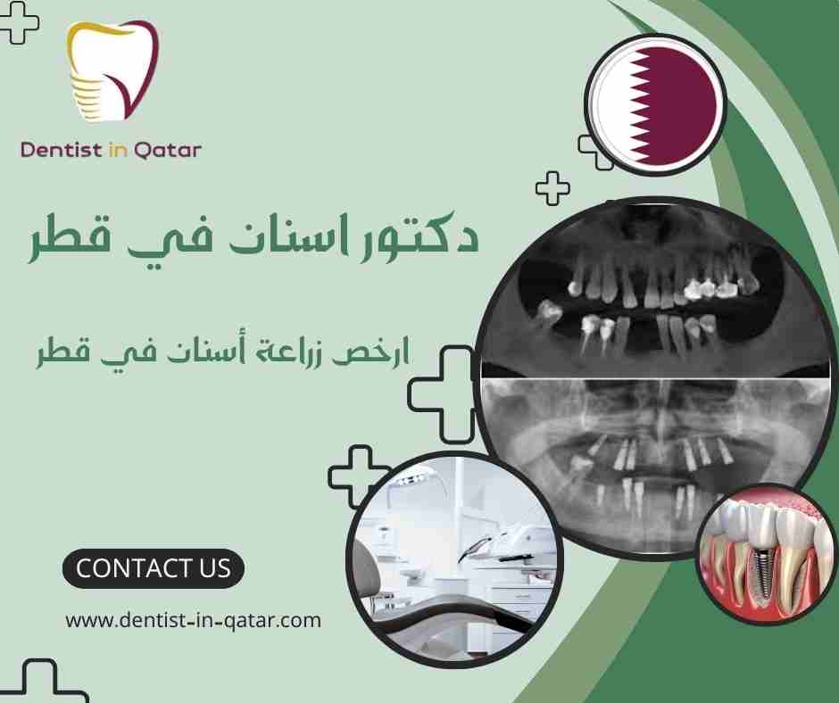  ارخص زراعة أسنان في قطر