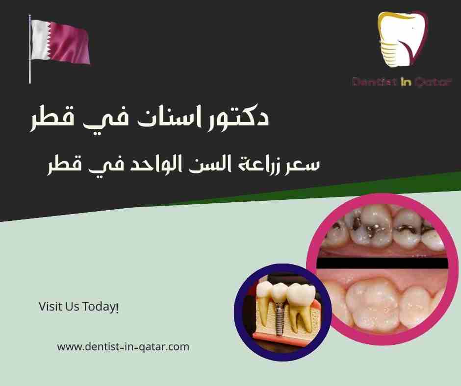 سعر زراعة السن الواحد في قطر
