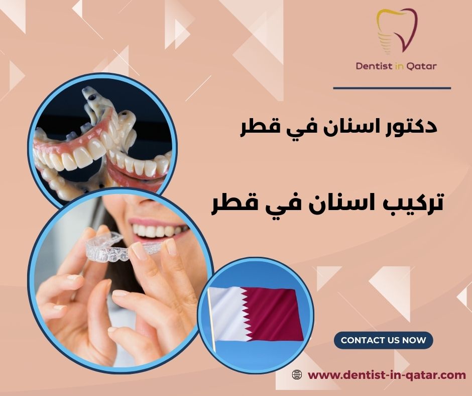 تركيب اسنان قطر