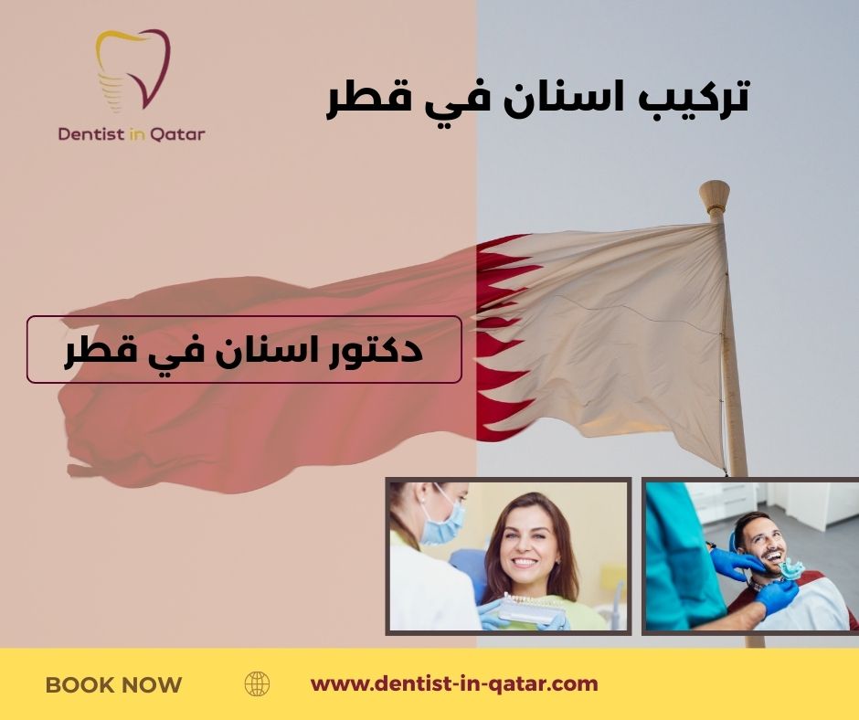 سعر تركيب الأسنان في قطر