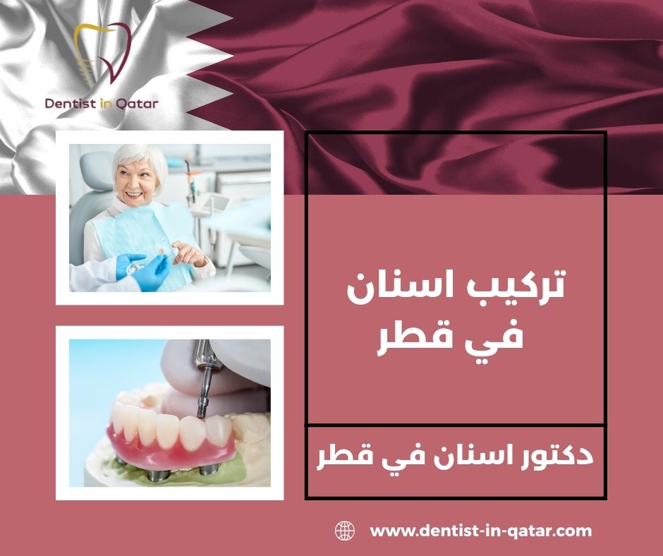 أسعار عيادات الأسنان في قطر