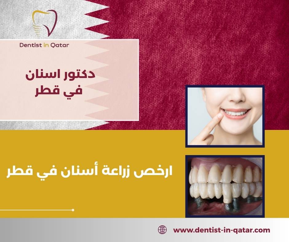  ارخص زراعة أسنان في قطر