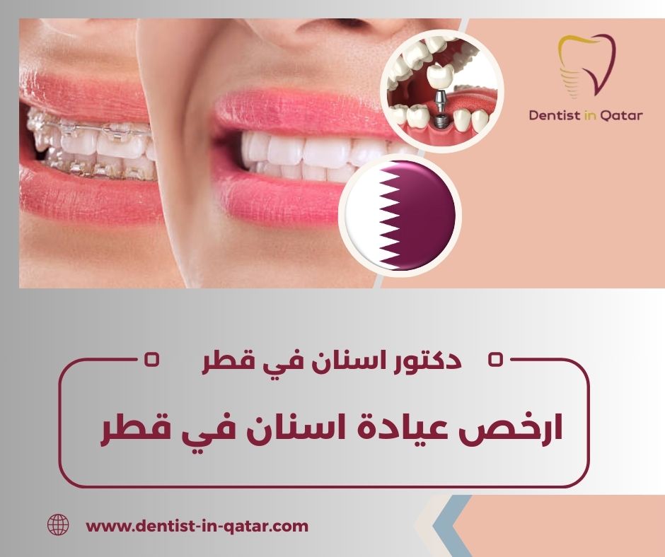 ارخص عيادة اسنان في قطر
