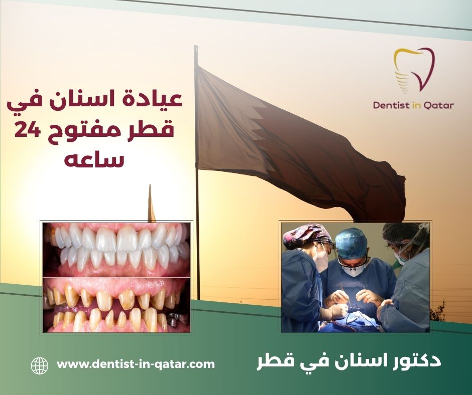 عيادة اسنان في قطر مفتوح 24 ساعه