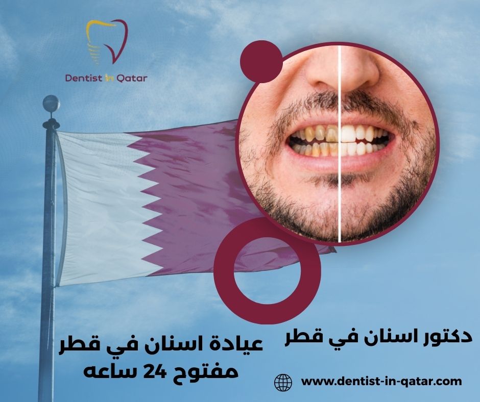 عيادة اسنان في قطر ٢٤ ساعه