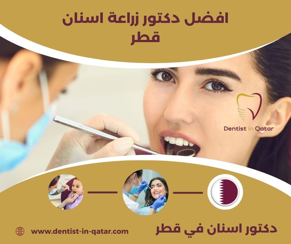 أفضل دكتور زراعة اسنان في قطر