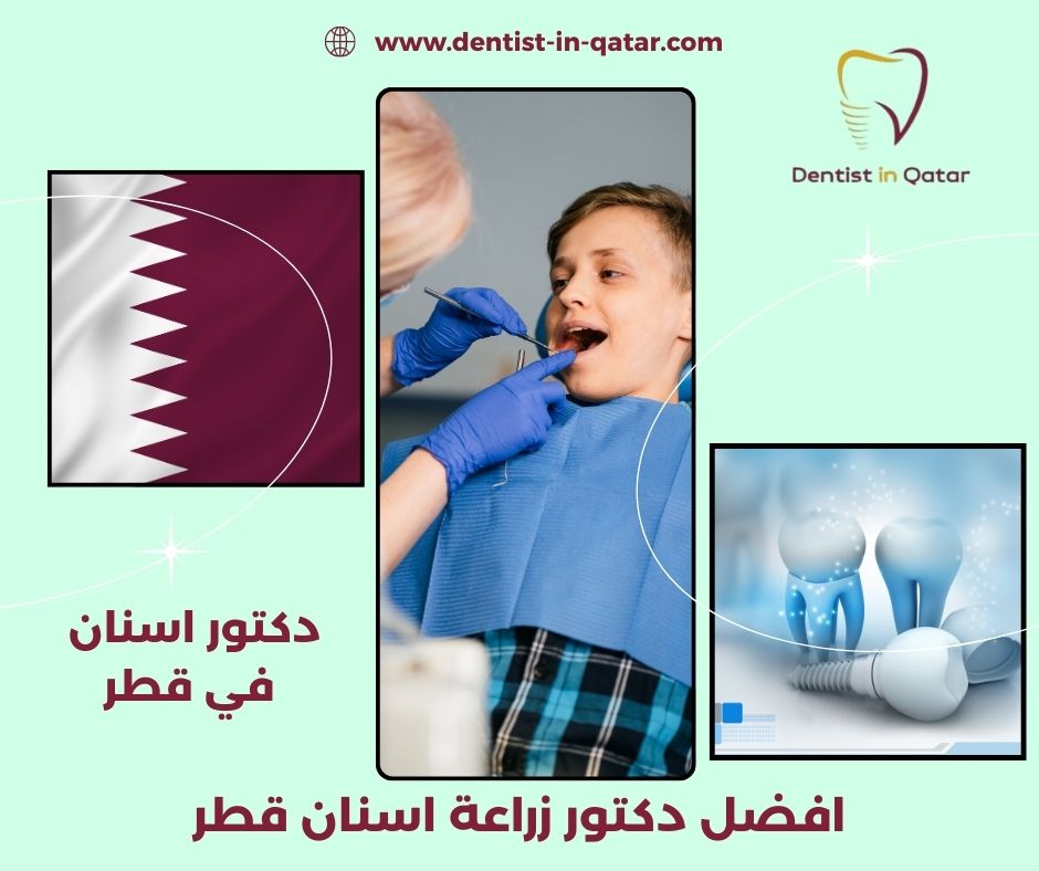 دكتور زراعة اسنان قطر