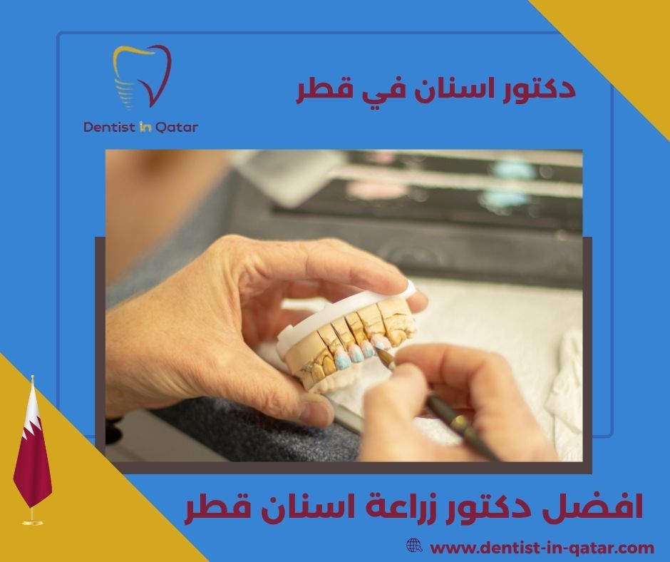 افضل دكتور زراعة اسنان قطر