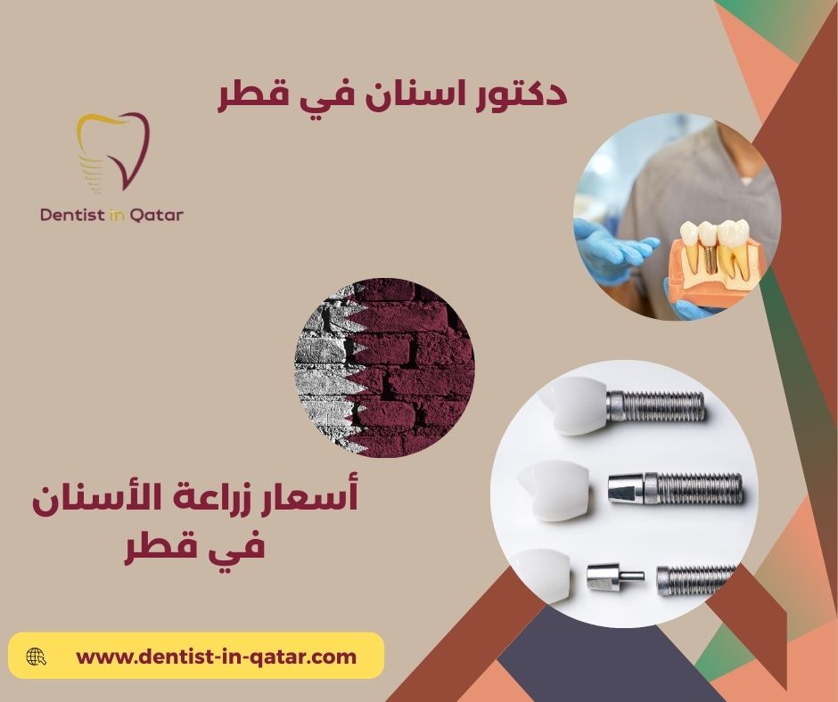 زراعة الأسنان الفورية في قطر