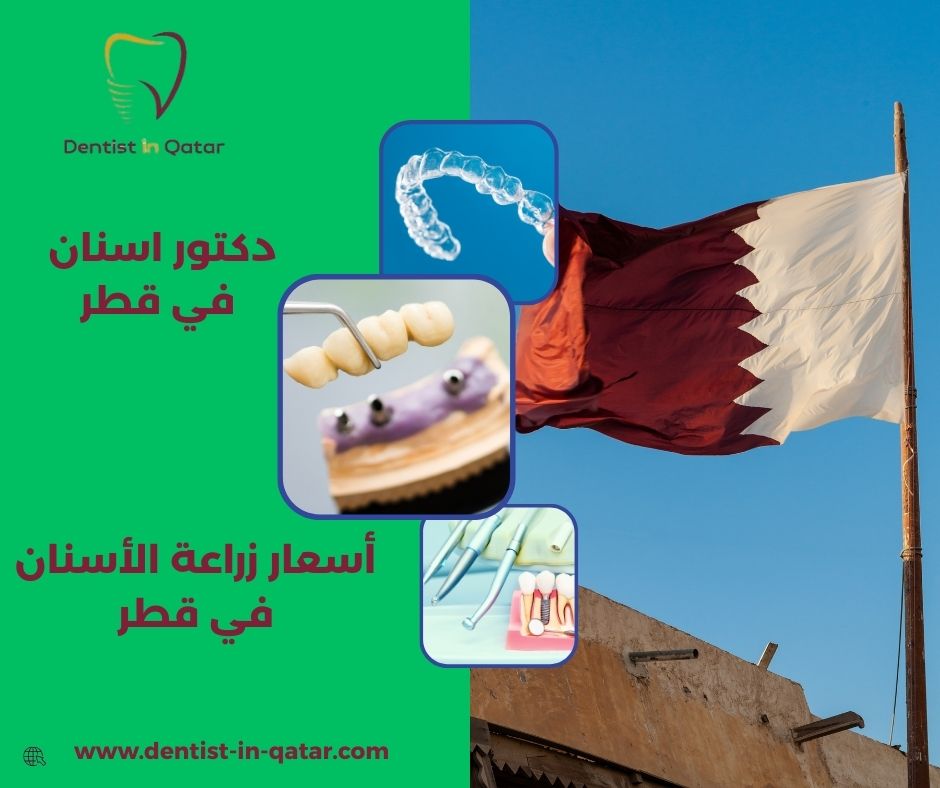 اسعار زراعة الاسنان قطر