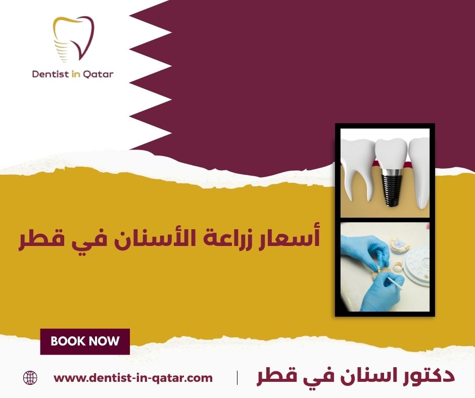 أسعار زراعة الأسنان في قطر