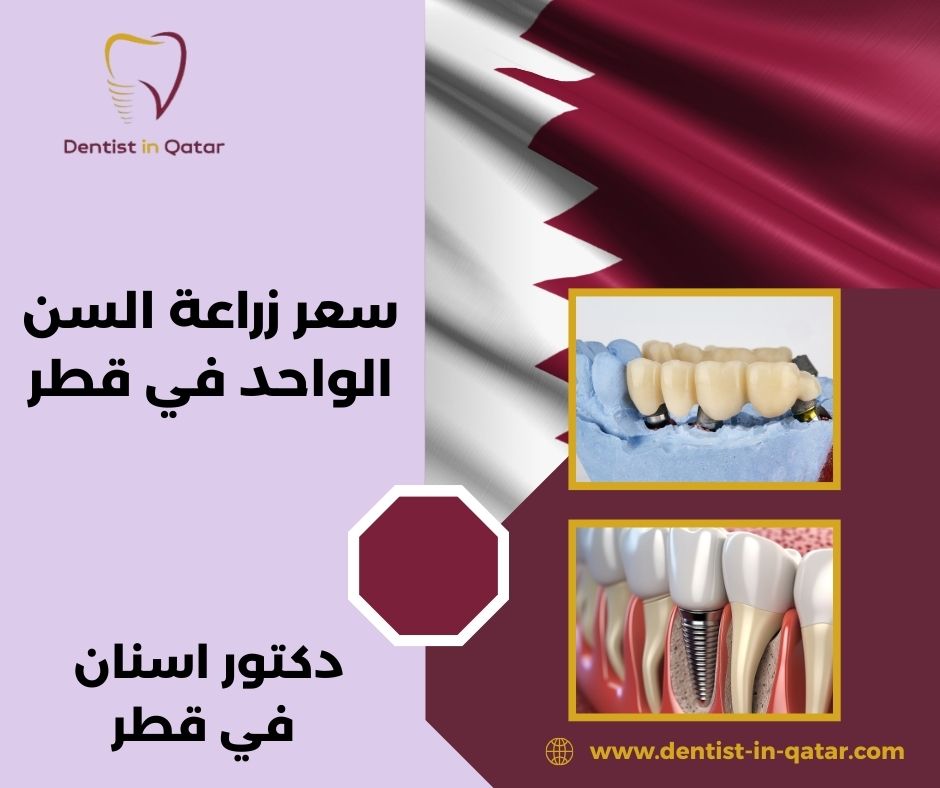أسعار زراعة الأسنان في قطر
