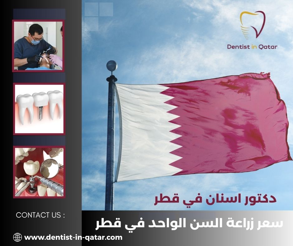 سعر زراعة الاسنان في قطر