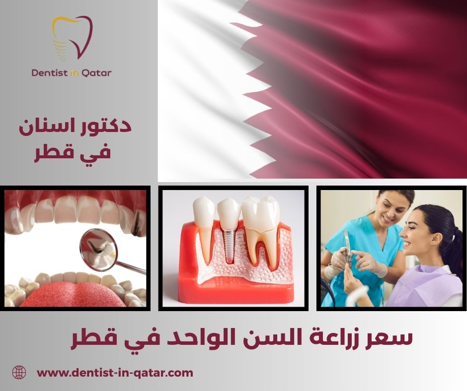 سعر زراعة السن في قطر