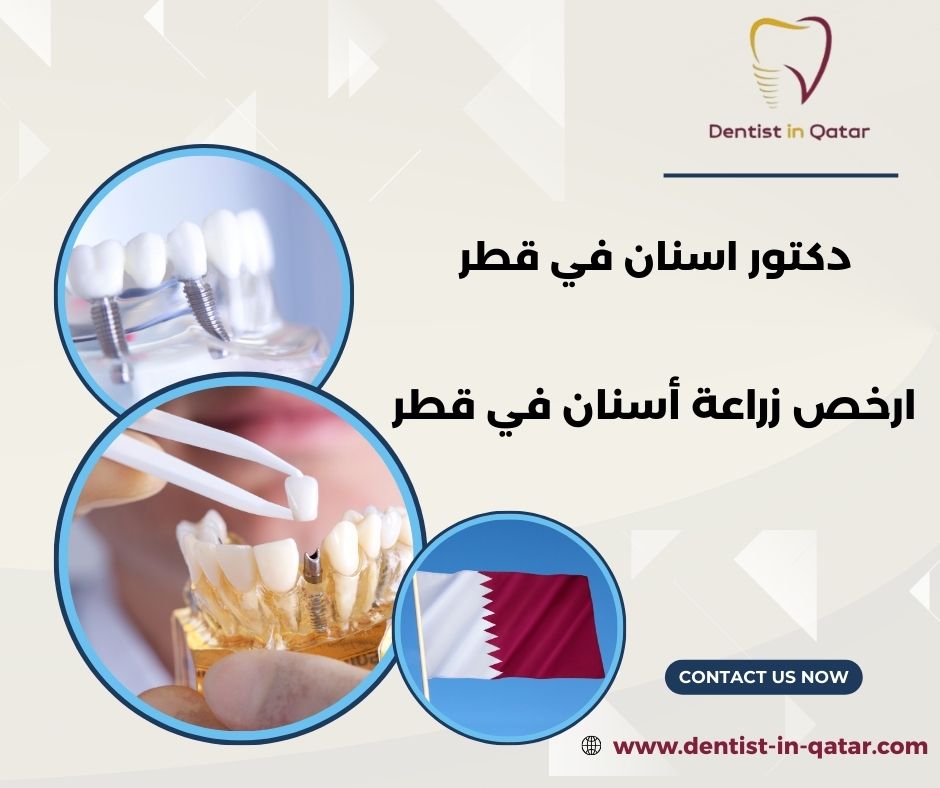 اسعار زراعه الاسنان في قطر