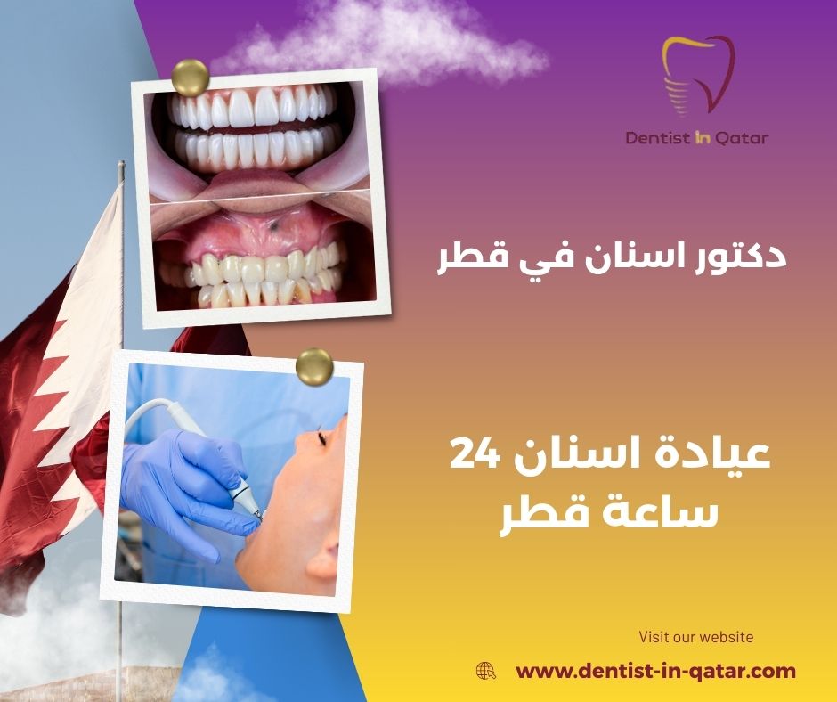 عيادة اسنان 24 ساعة في قطر