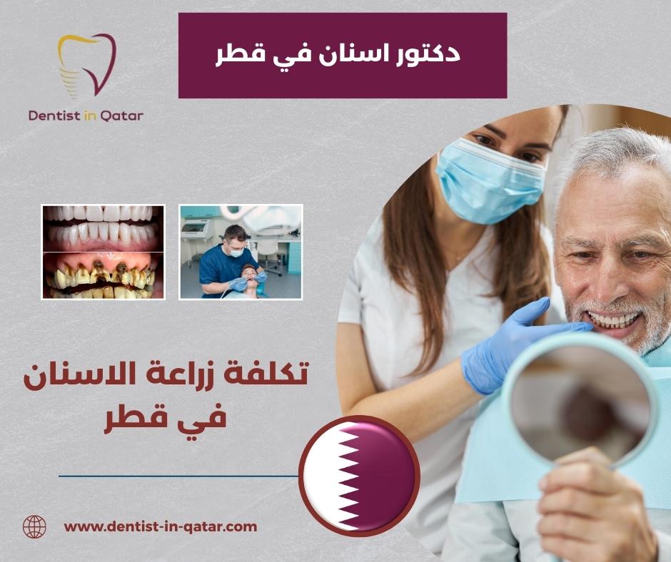 تكلفة زراعة الاسنان في قطر