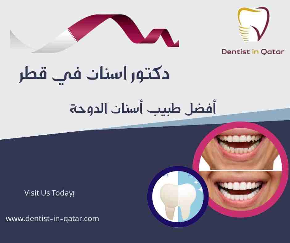 أفضل طبيب أسنان الدوحة