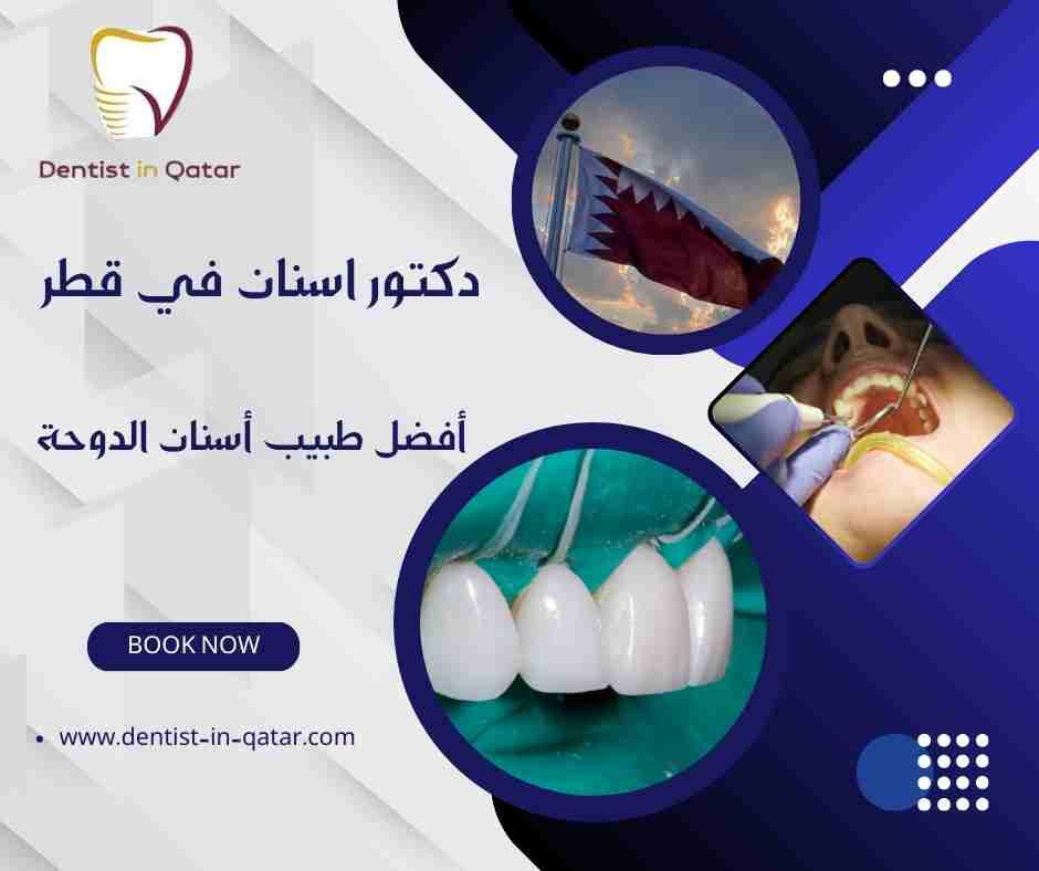 أفضل طبيب أسنان الدوحة