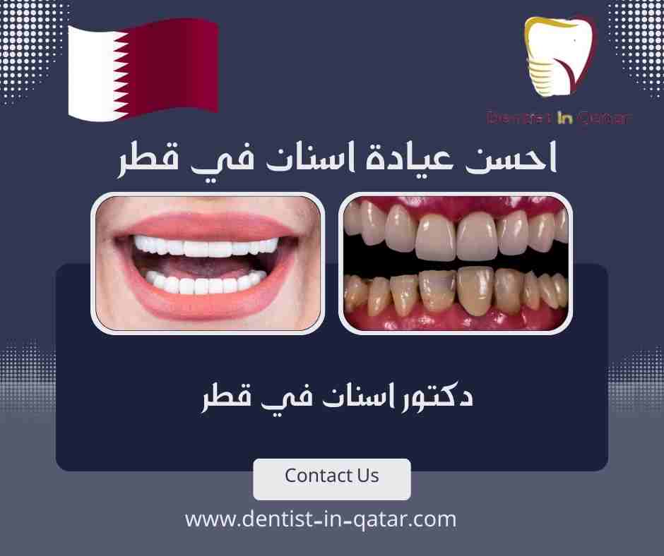 احسن عيادة اسنان في قطر