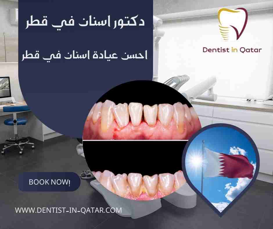 احسن عيادة اسنان في قطر