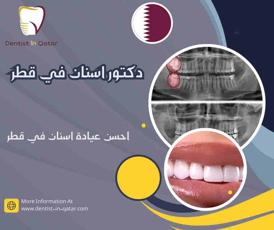 احسن عيادة اسنان في قطر