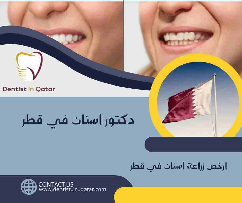 ارخص زراعة اسنان في قطر