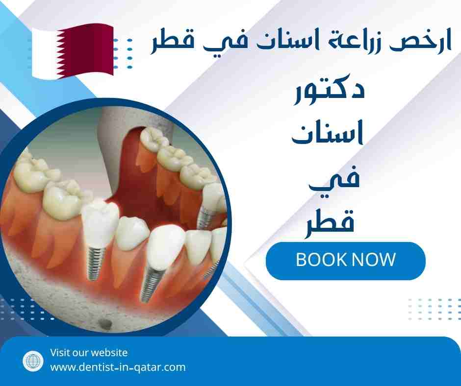 ارخص زراعة اسنان في قطر