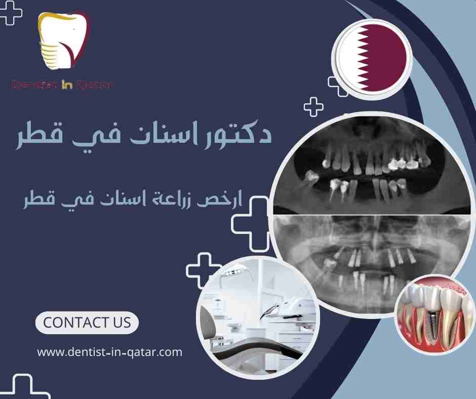 ارخص زراعة اسنان في قطر