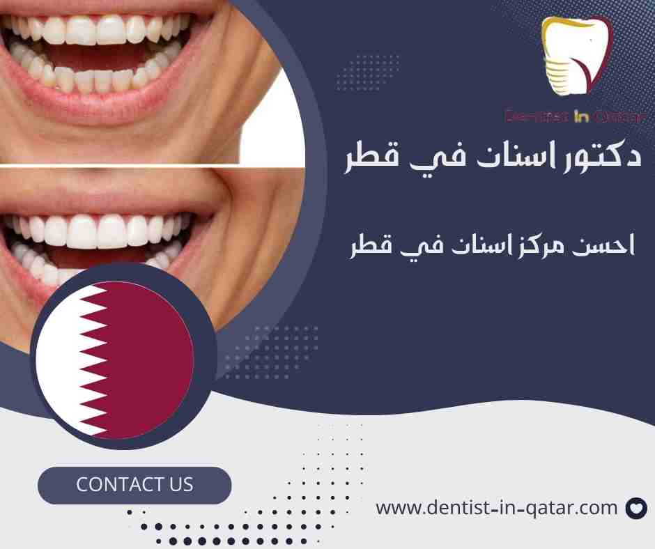 احسن مركز اسنان في قطر